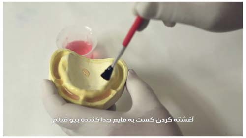 یکی از مراحل ساخت پروتز دندان به روش کستینگ