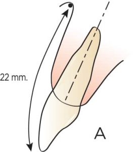 موقعیت طبیعی دندان