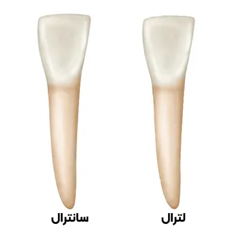 آناتومی-دندان-لترال-پایین-3