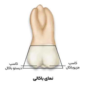 آناتومی دندان مولار اول قسمت1-4
