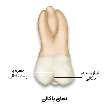 آناتومی دندان مولار اول قسمت1-5