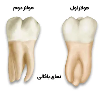 آناتومی-دندان-مولار-دوم-3