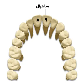 آناتومی سانترال فک بالا 2