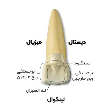 آناتومی سانترال فک بالا 4