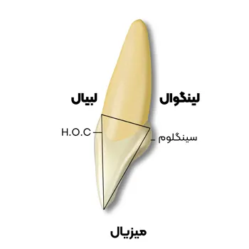 آناتومی سانترال فک بالا 5