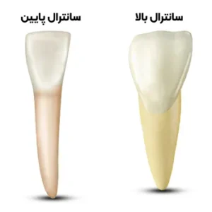 آناتومی-سانترال-فک-پایین-1