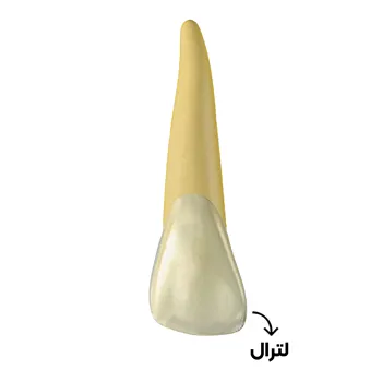 دندان-لترال-بالا