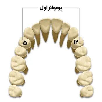 شماره-پرمولار-اول-فک-بالا-در-سیستم-یونیورسال