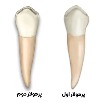 مقایسه-ظاهری-پرمولار-اول-و-پرمولار-دوم
