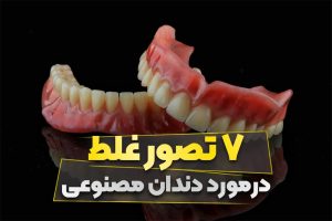 7 تصور غلط درمورد دندان مصنوعی