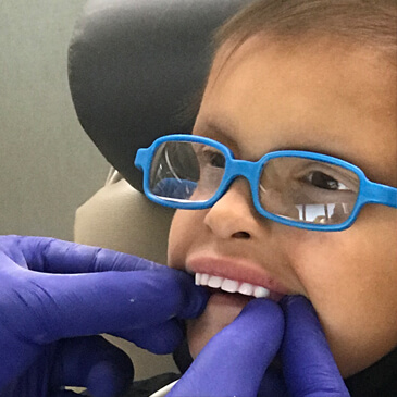 کودک با دندان مصنوعی تصور غلط در مورد دندان مصنوعی که فقط افراد مسن استفاده میکنند