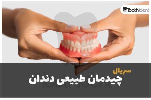 آموزش چیدن طبیعی دندان مصنوعی