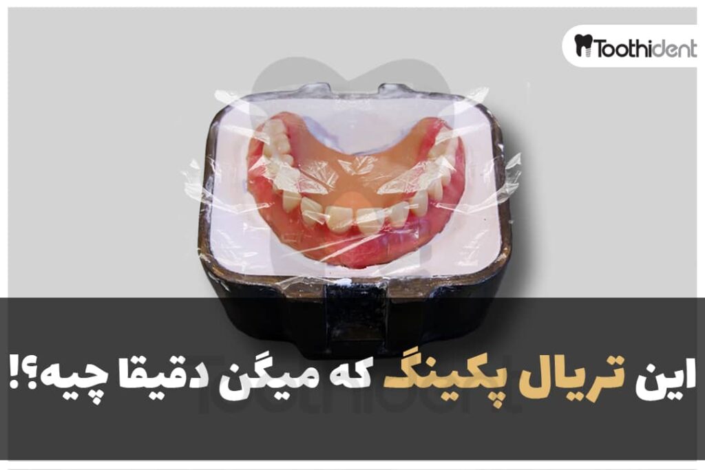 یک روکش پلاستیکی که روی دندان مصنوعی کشیده شده است برای روش تریال پکینگ
