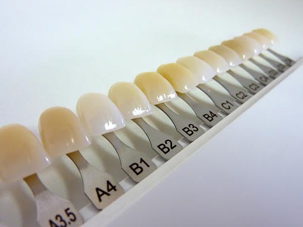 نمونه رنگ یا shade guide ضدعفونی لابراتوار دندان‌سازی