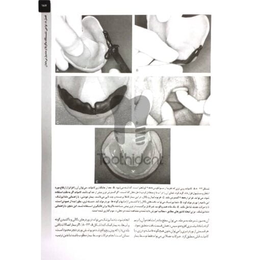 نمونه-صفحه-کتاب-درمان-پروتزی-بیماران-بی-دندان-زارب-2013--2