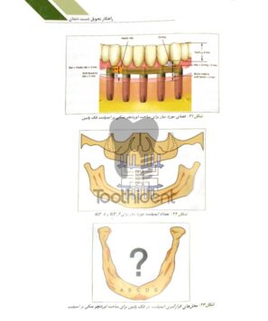 نمونه-صفحه-کتاب-راهکار-تحویل-دست-دندان-2