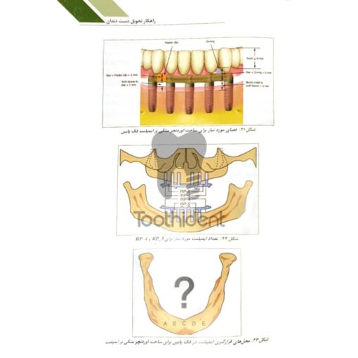 نمونه-صفحه-کتاب-راهکار-تحویل-دست-دندان-2