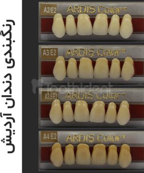 رنگبندی-دندان-مصنوعی-آردیش
