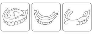 نحوه-استفاده-از-چسب-دندان-مصنوعی-مروابن